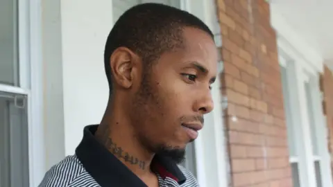 BBC Devrone McKnight still has pieces of bullets embedded in his cheek and neck