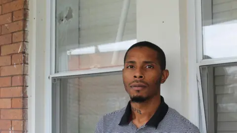 BBC Devrone McKnight still has pieces of bullets embedded in his cheek and neck