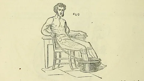 Creative Commons This diagram from Pulvermacher’s manual shows the way that Charles Dickens may have treated his leg pain (Credit: Creative Commons)