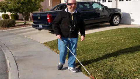 Second Sight Screen grab of man wearing Argus II device