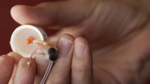 Second Sight Argus II device screen grab